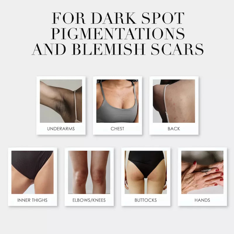 TREATMENT BAR TRIO