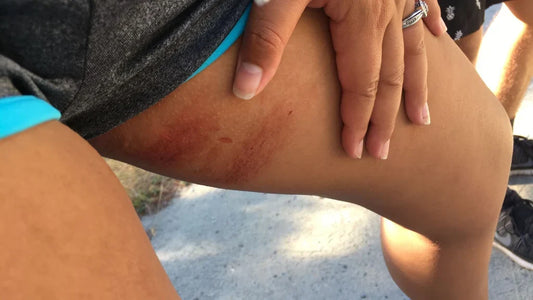 How to Prevent Chafing: Why Your Chafe Stick May Not Be Enough