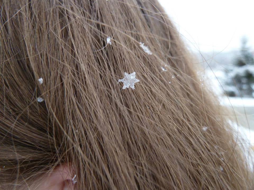 New Science Reveals An Unknown Cause of Dandruff