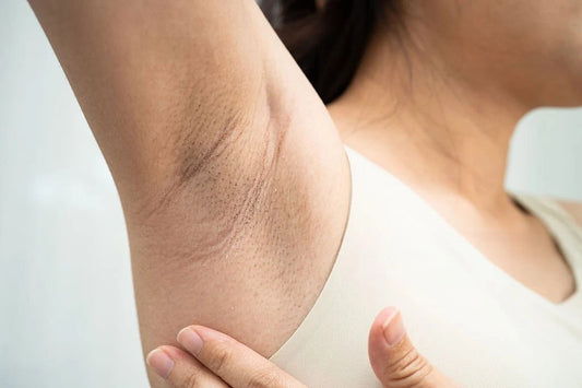 Can Hair Removal Make Your Underarms Look Darker? Here's What Could Be Happening