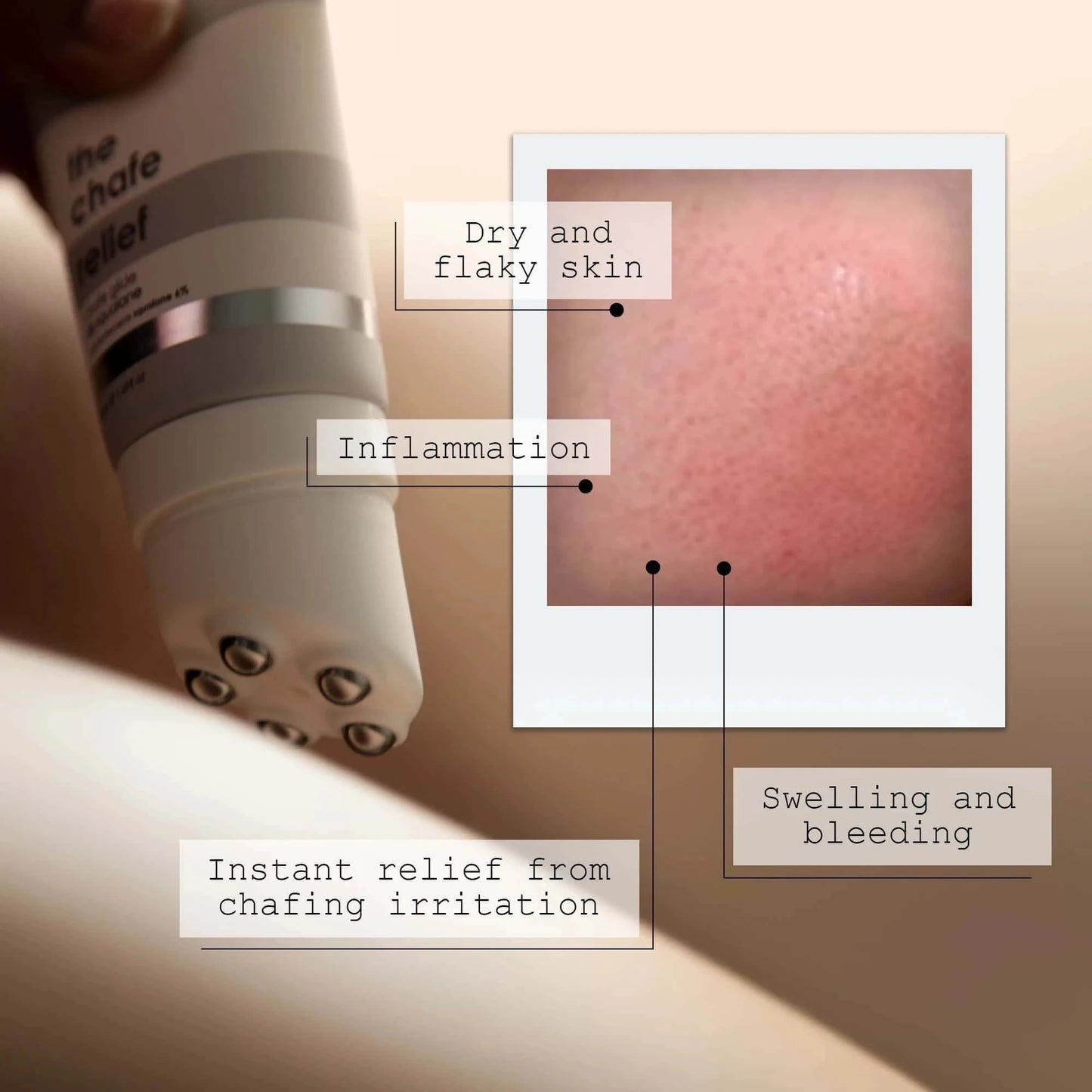 THE CHAFE RELIEF KIT