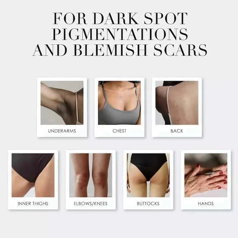 THE KOJIC ACID BAR