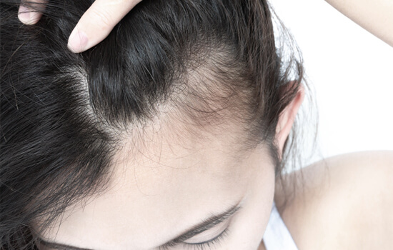 How to Get Rid of Scalp Acne  US Dermatology Partners